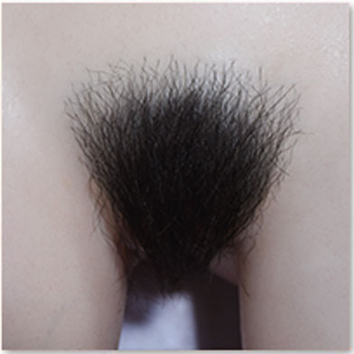 #2 Pubic Hair